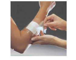 FILM ADESIVO IN POLIURETANO IN ROTOLO TRASPARENTE IMPERMEABILE PER FISSAGGIO DI MEDICAZIONI E CATETERI 5X1000 1MED - Farmacia Murachelli Di Putelli dr. Giovanni