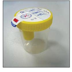 KIT CONTENITORE URINA SECUR BOX TAPPO GIALLO A VITE CON PUNTO DI PRELIEVO 120 ML 1 PEZZO - Farmacia Murachelli Di Putelli dr. Giovanni
